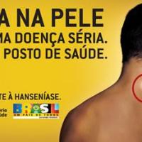 Foto Divulgação: Preconceito afasta pessoas com hanseníase do tratamento