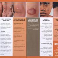 Foto Divulgação: Preconceito afasta pessoas com hanseníase do tratamento